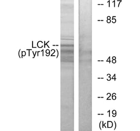 Western Blot - Anti-Lck (phospho Tyr192) Antibody (A0506) - Antibodies.com