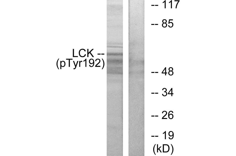 Western Blot - Anti-Lck (phospho Tyr192) Antibody (A0506) - Antibodies.com
