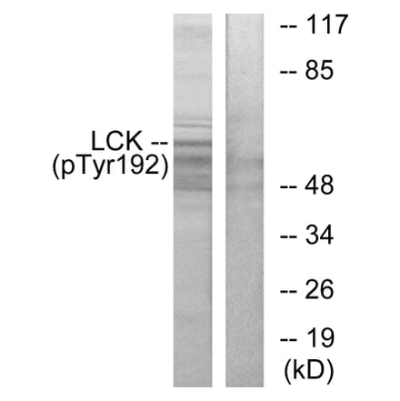 Western Blot - Anti-Lck (phospho Tyr192) Antibody (A0506) - Antibodies.com