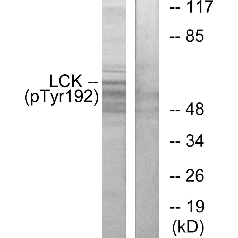 Western Blot - Anti-Lck (phospho Tyr192) Antibody (A0506) - Antibodies.com
