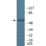 Western Blot - Anti-Lck (phospho Tyr192) Antibody (P12-1135) - Antibodies.com
