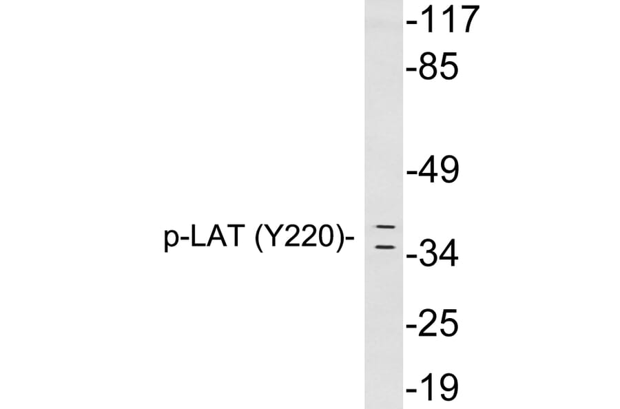 Western Blot - Anti-LAT (phospho Tyr220) Antibody (P12-1031) - Antibodies.com