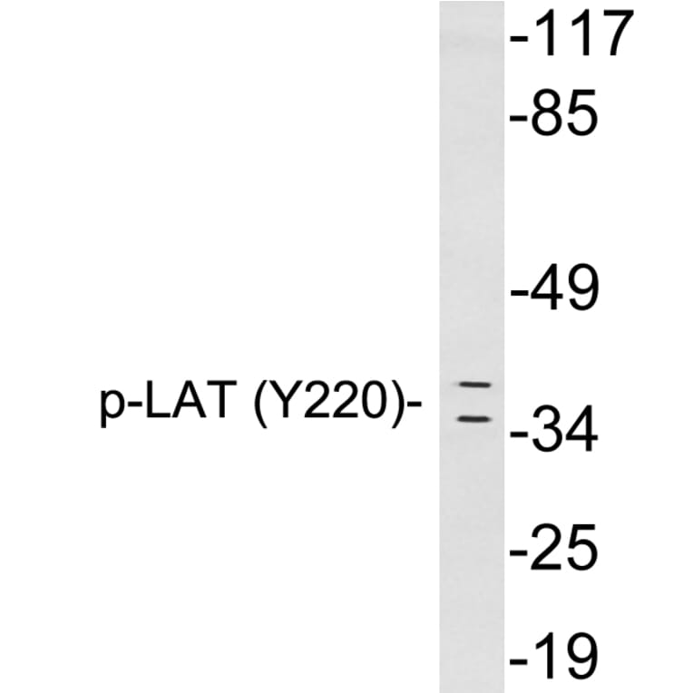 Western Blot - Anti-LAT (phospho Tyr220) Antibody (P12-1031) - Antibodies.com