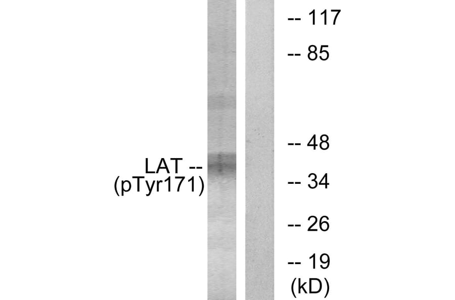 Western Blot - Anti-LAT (phospho Tyr171) Antibody (A0669) - Antibodies.com