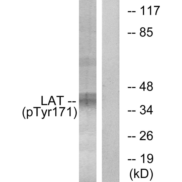 Western Blot - Anti-LAT (phospho Tyr171) Antibody (A0669) - Antibodies.com