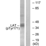 Western Blot - Anti-LAT (phospho Tyr171) Antibody (A0669) - Antibodies.com