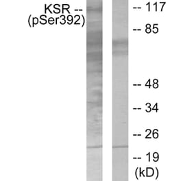 Western Blot - Anti-KSR (phospho Ser392) Antibody (A0075) - Antibodies.com