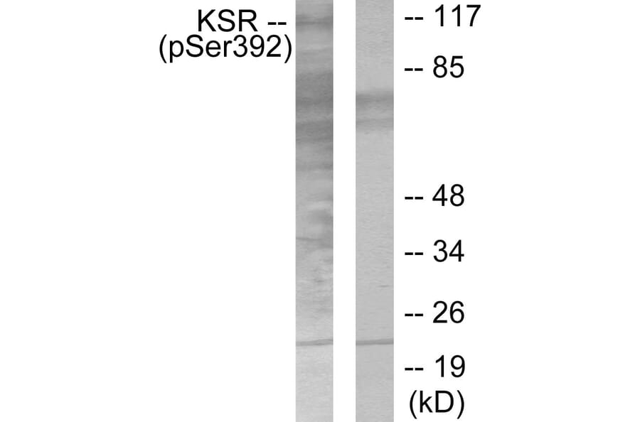 Western Blot - Anti-KSR (phospho Ser392) Antibody (A0075) - Antibodies.com