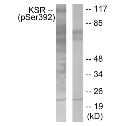 Western Blot - Anti-KSR (phospho Ser392) Antibody (A0075) - Antibodies.com