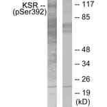 Western Blot - Anti-KSR (phospho Ser392) Antibody (A0075) - Antibodies.com