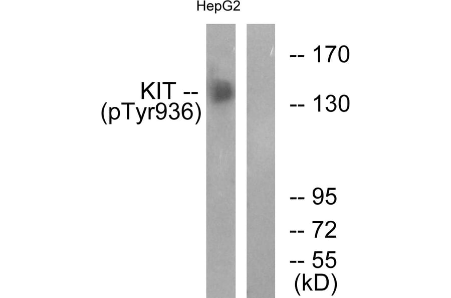 Western Blot - Anti-KIT (phospho Tyr936) Antibody (A0501) - Antibodies.com