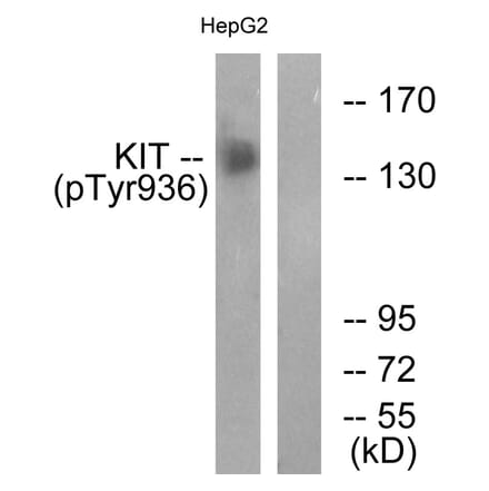 Western Blot - Anti-KIT (phospho Tyr936) Antibody (A0501) - Antibodies.com