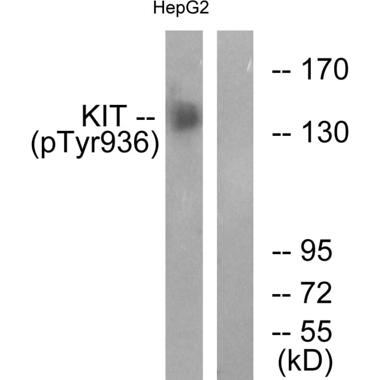 Western Blot - Anti-KIT (phospho Tyr936) Antibody (A0501) - Antibodies.com