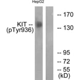 Western Blot - Anti-KIT (phospho Tyr936) Antibody (A0501) - Antibodies.com