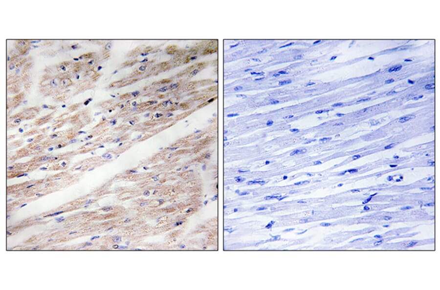 Immunohistochemistry - Anti-KIT (phospho Tyr936) Antibody (A0501) - Antibodies.com