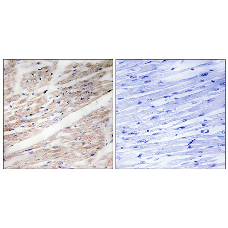 Immunohistochemistry - Anti-KIT (phospho Tyr936) Antibody (A0501) - Antibodies.com