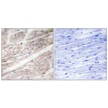 Immunohistochemistry - Anti-KIT (phospho Tyr936) Antibody (A0501) - Antibodies.com