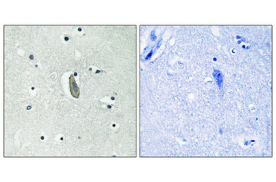 Immunohistochemistry - Anti-KIT (phospho Tyr936) Antibody (A0501) - Antibodies.com