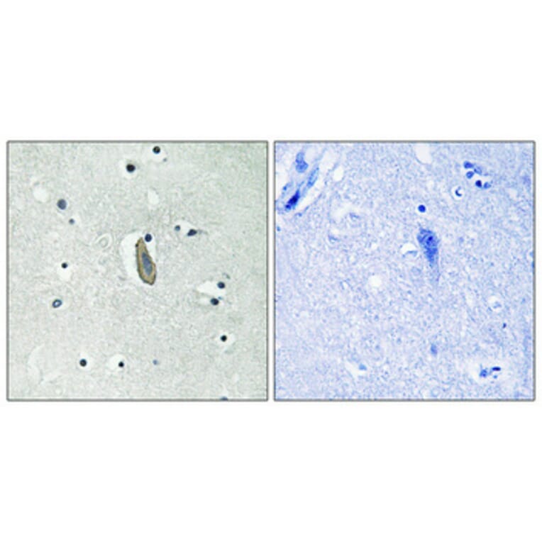 Immunohistochemistry - Anti-KIT (phospho Tyr936) Antibody (A0501) - Antibodies.com