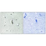 Immunohistochemistry - Anti-KIT (phospho Tyr936) Antibody (A0501) - Antibodies.com