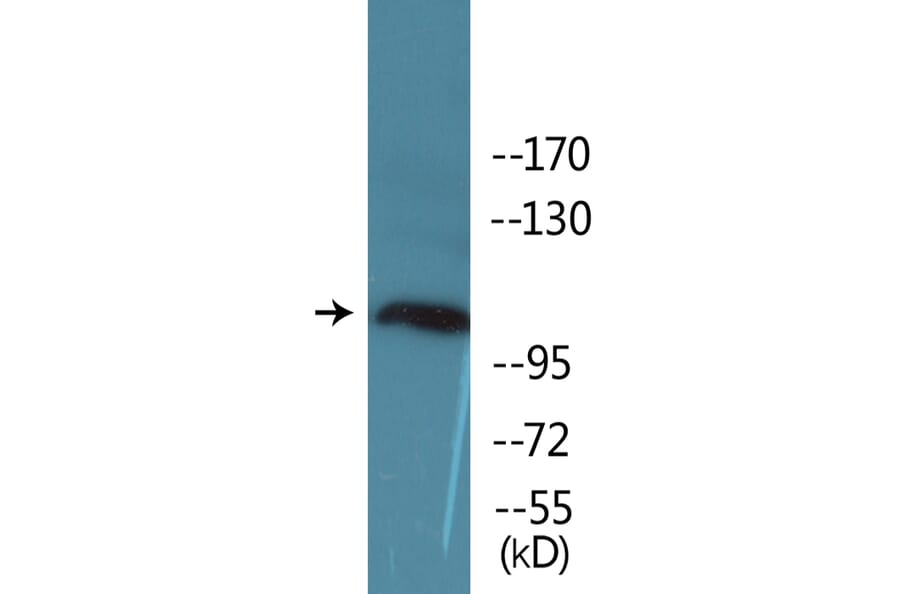Western Blot - Anti-KIT (phospho Tyr936) Antibody (P12-1132) - Antibodies.com
