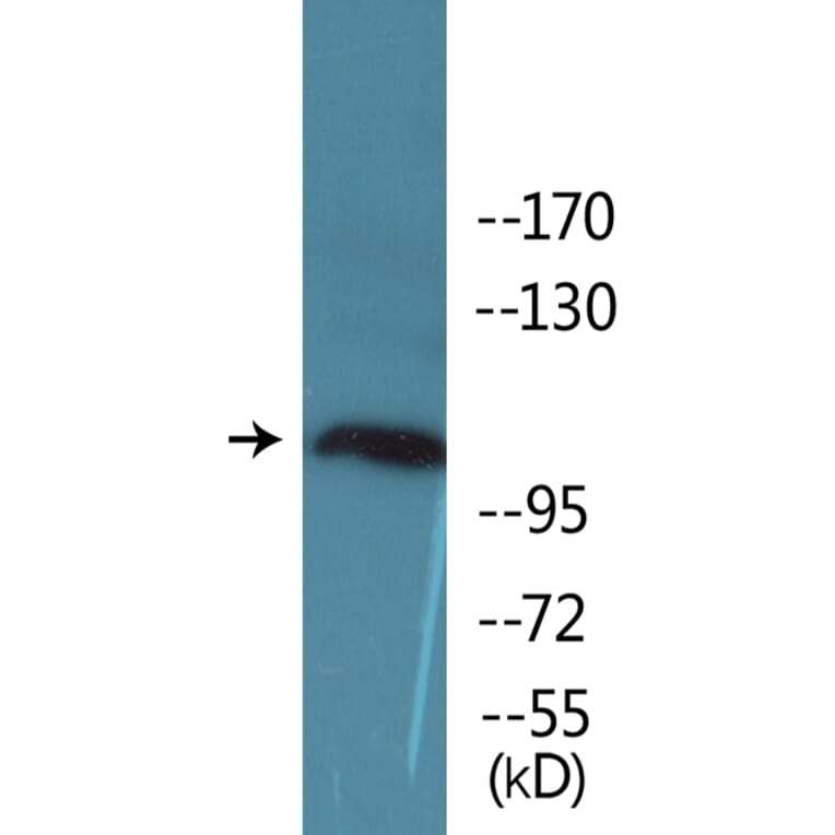 Western Blot - Anti-KIT (phospho Tyr936) Antibody (P12-1132) - Antibodies.com