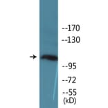Western Blot - Anti-KIT (phospho Tyr936) Antibody (P12-1132) - Antibodies.com