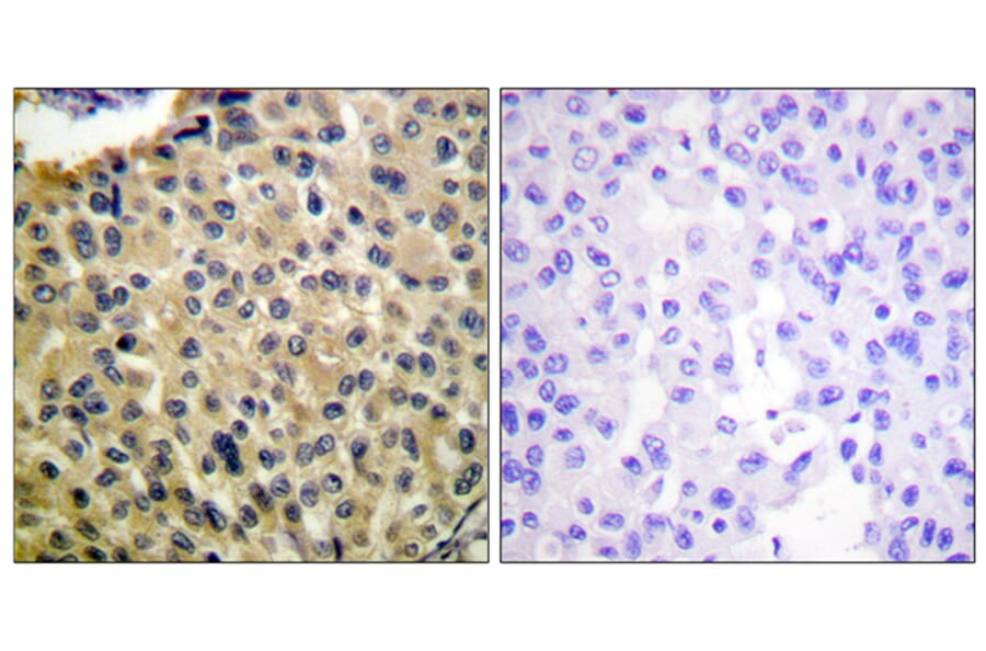 Immunohistochemistry - Anti-KIT (phospho Tyr703) Antibody (A0502) - Antibodies.com