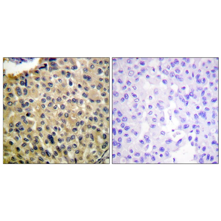 Immunohistochemistry - Anti-KIT (phospho Tyr703) Antibody (A0502) - Antibodies.com