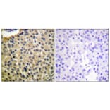 Immunohistochemistry - Anti-KIT (phospho Tyr703) Antibody (A0502) - Antibodies.com