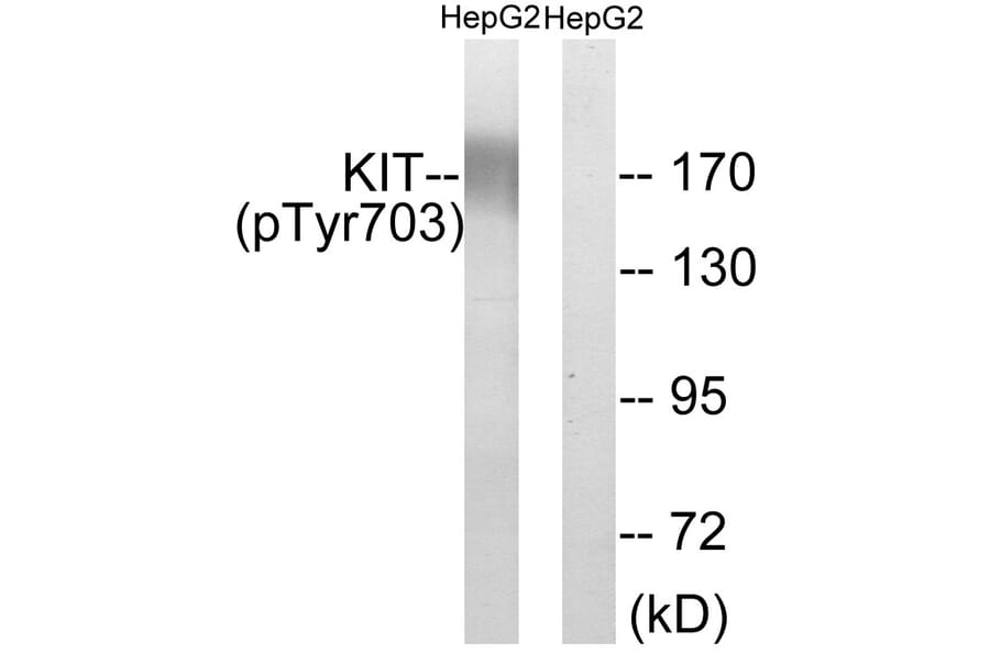 Western Blot - Anti-KIT (phospho Tyr703) Antibody (A0502) - Antibodies.com