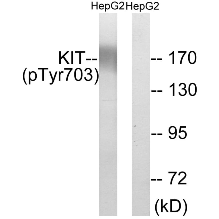 Western Blot - Anti-KIT (phospho Tyr703) Antibody (A0502) - Antibodies.com