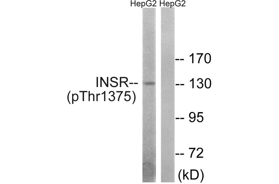 Western Blot - Anti-IR (phospho Thr1375) Antibody (A8116) - Antibodies.com