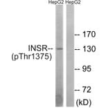 Western Blot - Anti-IR (phospho Thr1375) Antibody (A8116) - Antibodies.com