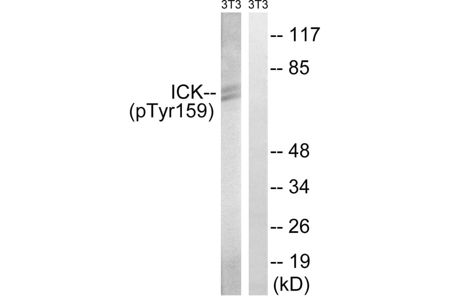 Western Blot - Anti-ICK (phospho Tyr159) Antibody (A8112) - Antibodies.com