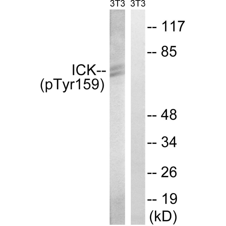 Western Blot - Anti-ICK (phospho Tyr159) Antibody (A8112) - Antibodies.com