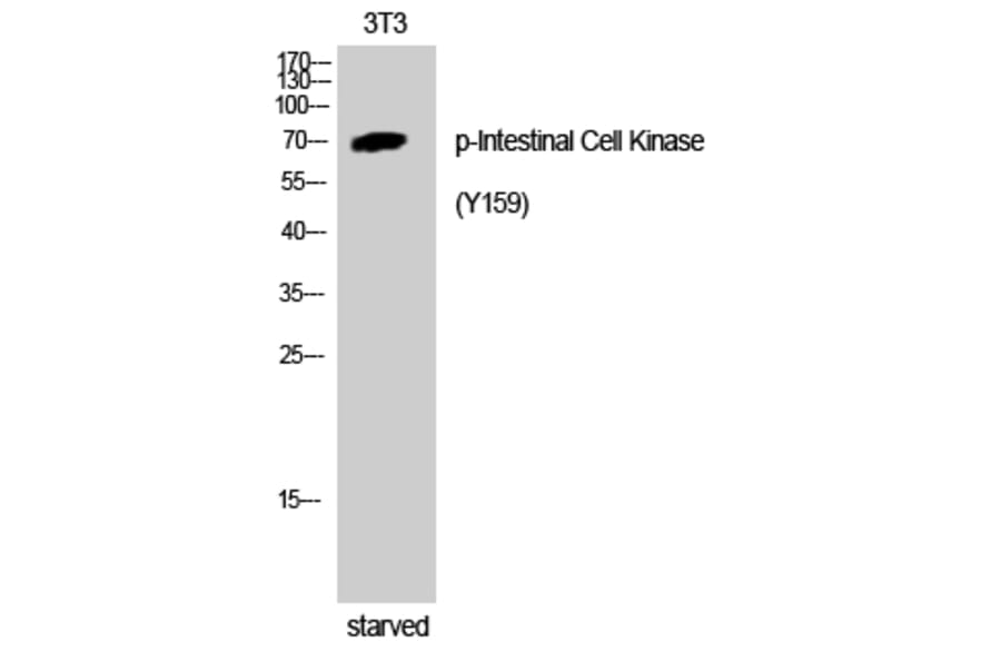 Western Blot - Anti-ICK (phospho Tyr159) Antibody (A8112) - Antibodies.com