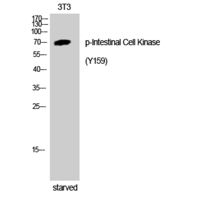 Western Blot - Anti-ICK (phospho Tyr159) Antibody (A8112) - Antibodies.com