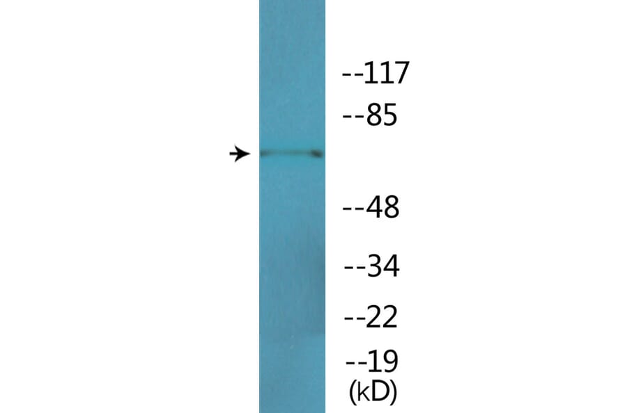 Western Blot - Anti-ICK (phospho Tyr159) Antibody (P12-1118) - Antibodies.com