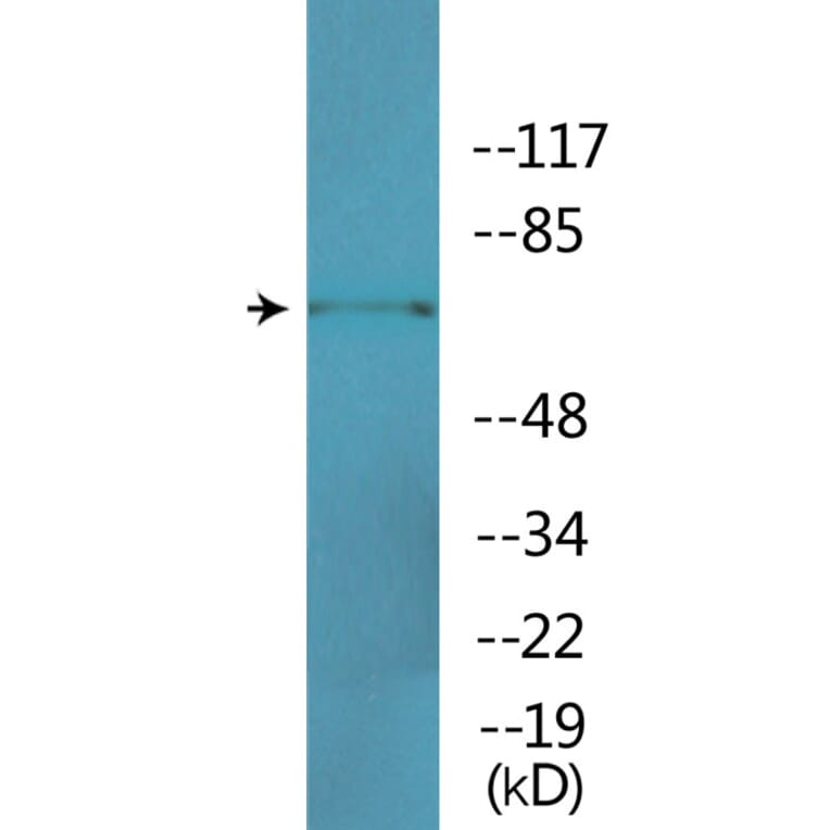 Western Blot - Anti-ICK (phospho Tyr159) Antibody (P12-1118) - Antibodies.com