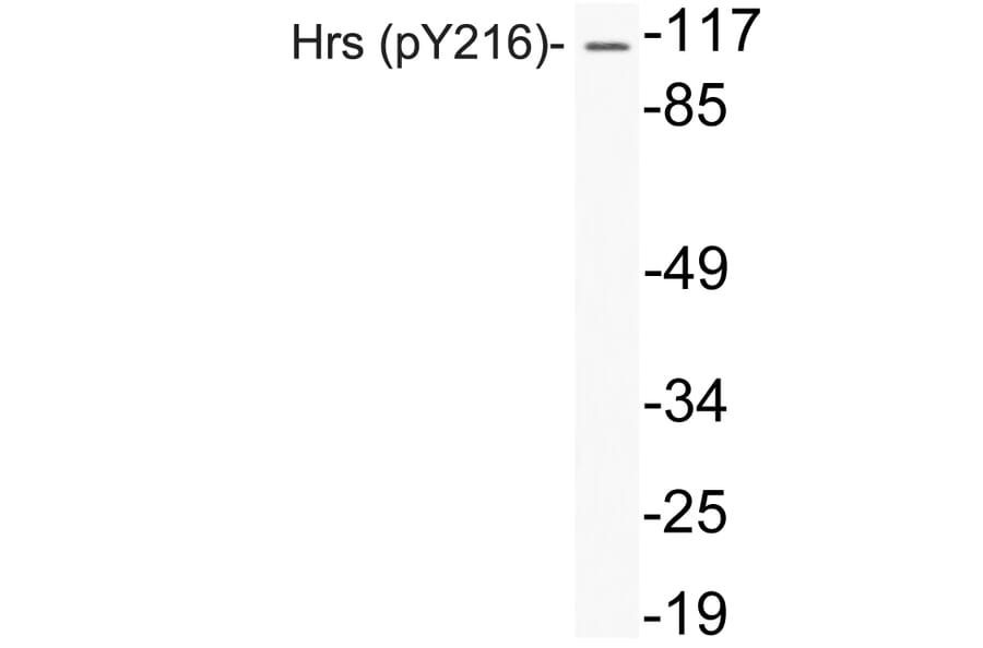 Western Blot - Anti-Hrs (phospho Tyr216) Antibody (P12-1027) - Antibodies.com