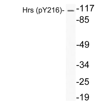 Western Blot - Anti-Hrs (phospho Tyr216) Antibody (P12-1027) - Antibodies.com