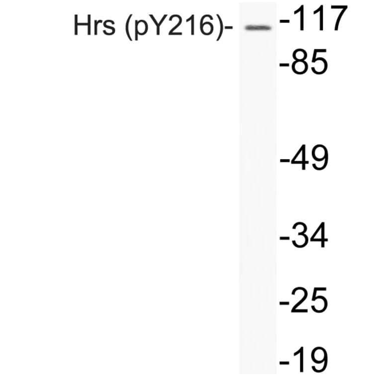 Western Blot - Anti-Hrs (phospho Tyr216) Antibody (P12-1027) - Antibodies.com