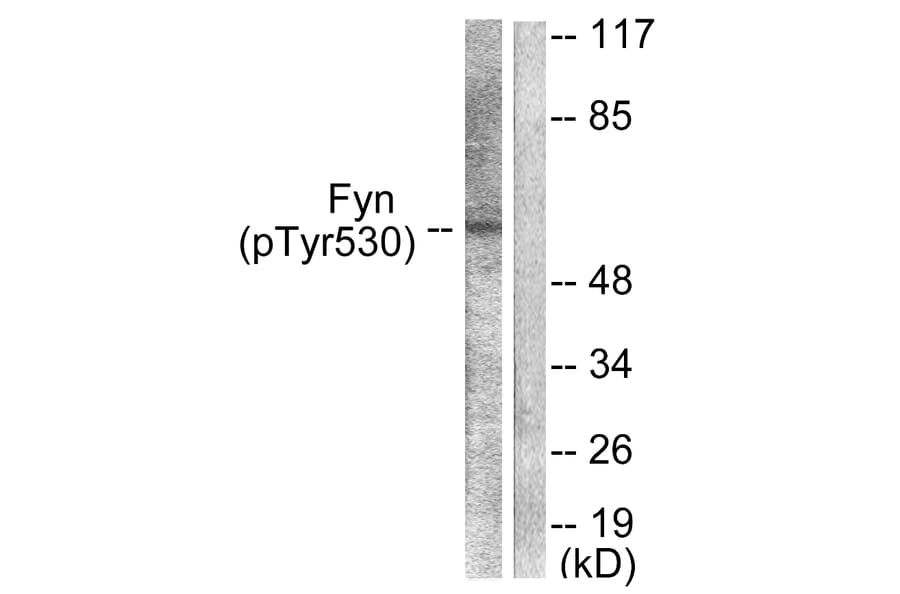 Western Blot - Anti-Fyn (phospho Tyr530) Antibody (A0430) - Antibodies.com