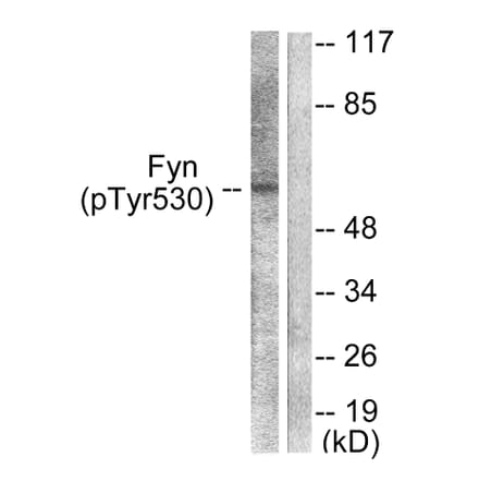 Western Blot - Anti-Fyn (phospho Tyr530) Antibody (A0430) - Antibodies.com