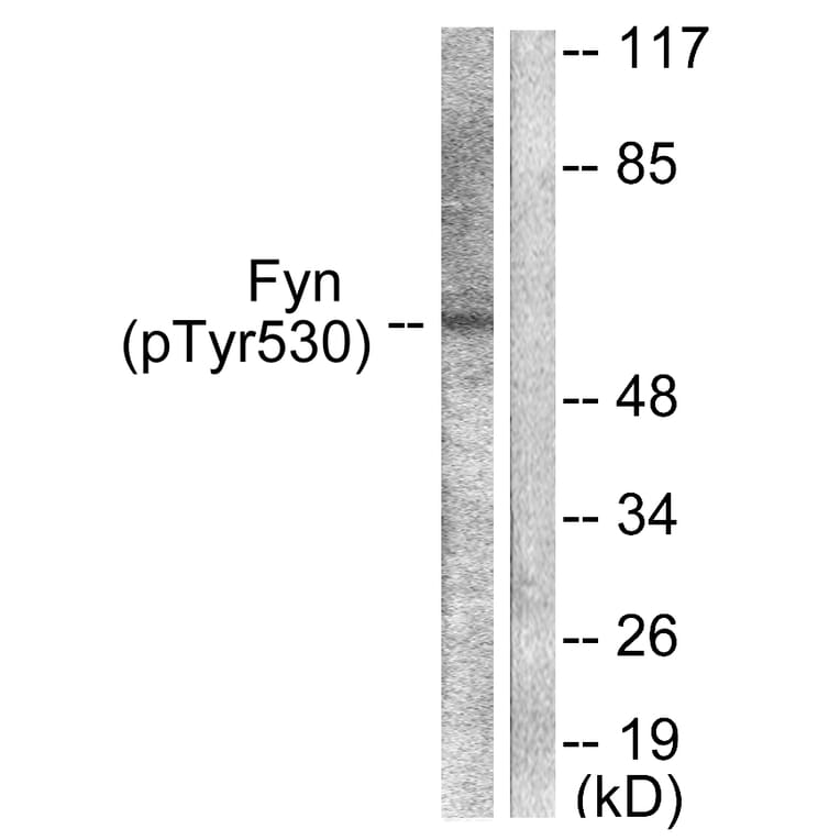 Western Blot - Anti-Fyn (phospho Tyr530) Antibody (A0430) - Antibodies.com