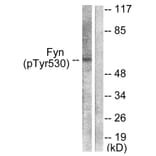 Western Blot - Anti-Fyn (phospho Tyr530) Antibody (A0430) - Antibodies.com