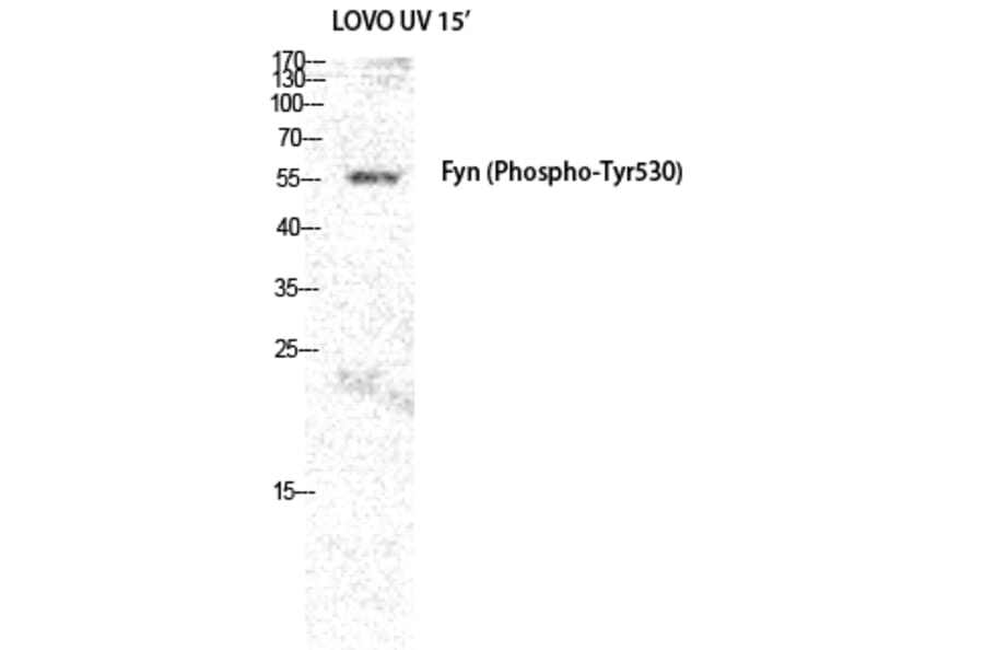 Western Blot - Anti-Fyn (phospho Tyr530) Antibody (A0430) - Antibodies.com