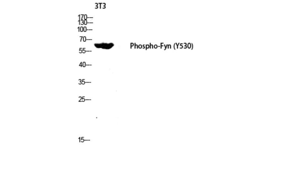 Western Blot - Anti-Fyn (phospho Tyr530) Antibody (A0430) - Antibodies.com