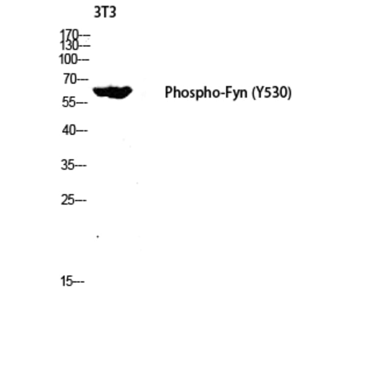Western Blot - Anti-Fyn (phospho Tyr530) Antibody (A0430) - Antibodies.com